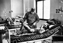 Burn Centre, a victim of domestic accident, 2010