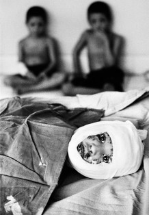 Burn Centre, Bibi Jan and, in the background, Mannak and Saifallah, three of six brothers victims of an explosion in Helmand Province, 2010