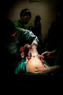 EMERGENCY's Maternity Centre, operating room, caesarean section, 2019.