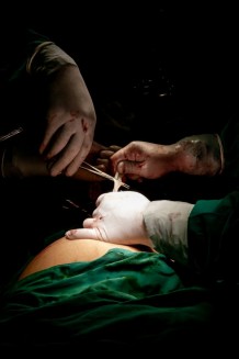 EMERGENCY's Maternity Centre, operating room, caesarean section, 2019. Cutting of the umbilical cord, 2019.