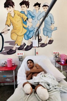 EMERGENCY'S Surgical Centre for War Victims. Haron, 13 years old, vistim of the explosion of an anti-personnel mine. He lost his legs, 3 fingers and both testicles. Kabul, Afghanistan, 2022