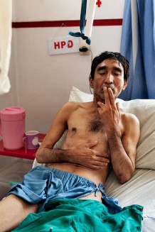 EMERGENCY'S Surgical Centre for War Victims. Wahidullah, 50 yers old, injured by a bullet. He is a heorin addict in withdrawal. He is miming the gesture of smoking. Kabul, Afghanistan, 2022