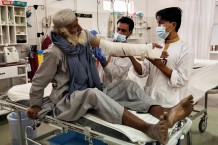 EMERGENCY's Surgical Centre for War Victims of Lashkar-Gah. Hazrat Gull, 80 years old, fractured, in the OPD. Helmand, Afghanistan, 2022