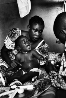 North Kivu, Goma, 2006. The child is sick with malaria.