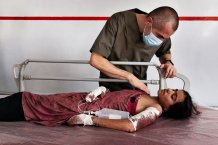 EMERGENCY'S Surgical Centre for War Victims. Fatima, 13 years old, victim of an explosion close to a mosque, rescued in the OPD. Kabul, Afghanistan, 2022